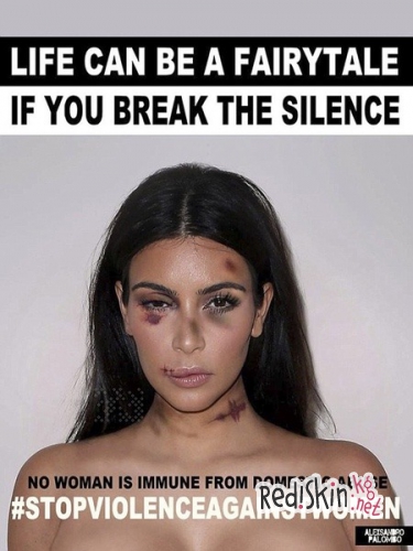 Майли Сайрус, Ким Кардашян, Мадонна и другие: В сети появились шокирующие снимки избитых знаменитостей