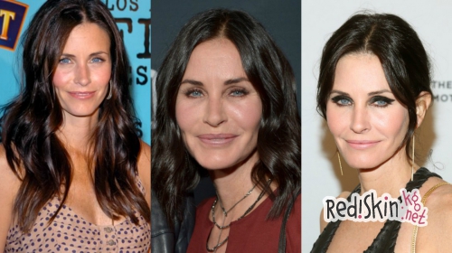 Знаменитости, утратившие свою красоту из-за пластики