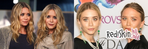 Знаменитости, утратившие свою красоту из-за пластики