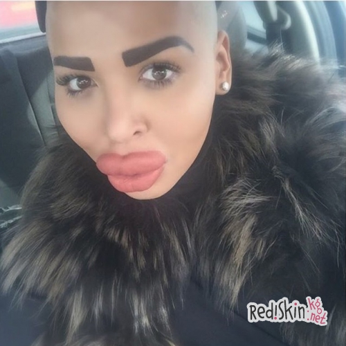 Одержимый пластической хирургией и семейством Кардашьян-Дженнер: 24-летний Джордан сделал нос как у Ким, а подбородок как у Кайли (видео)