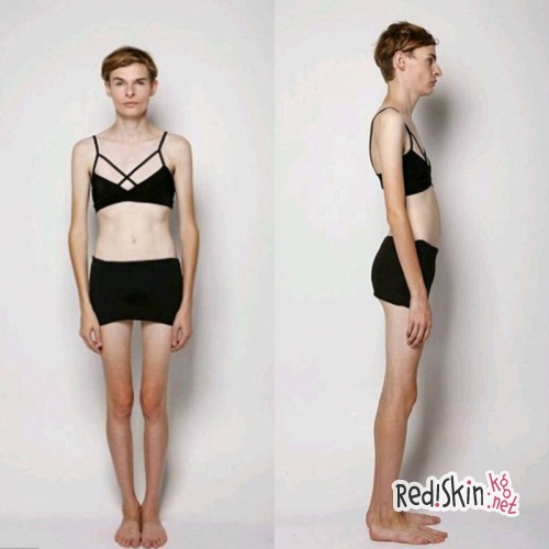 Гермафродит, который пытался покончить жизнь самоубийством 6 раз, стал моделью, чтобы накопить денег на операцию по коррекции пола