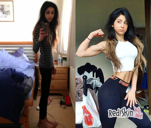 Похудеть до смерти: 25-летняя девушка из Шотландии рассказала как победила анорексию и стала фитнес-моделью